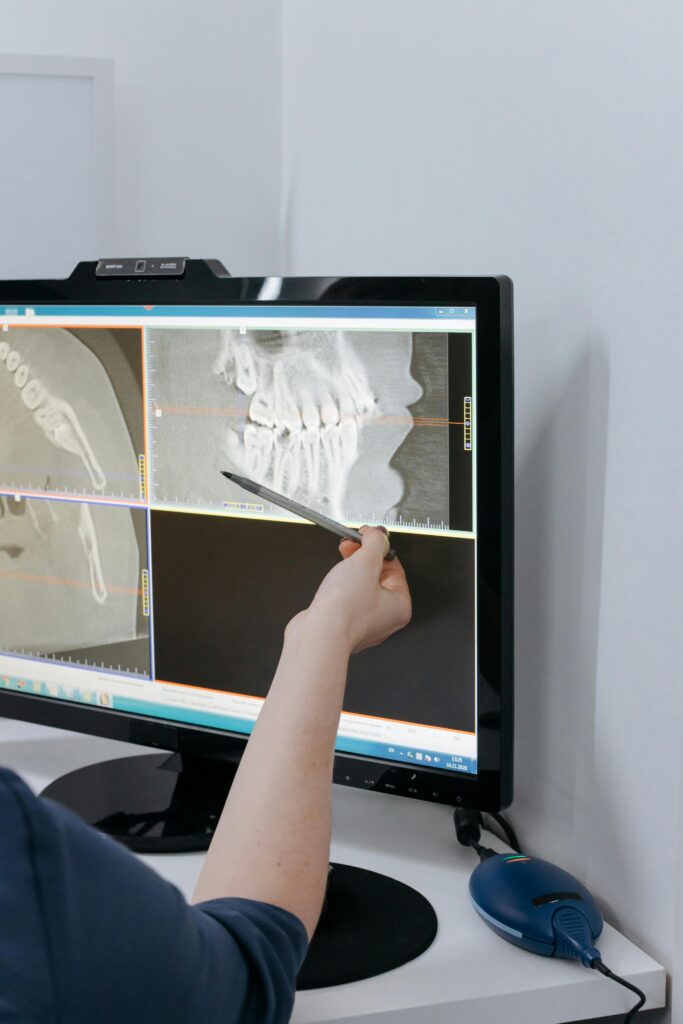 Person analyzing dental X-ray on screen in a medical office